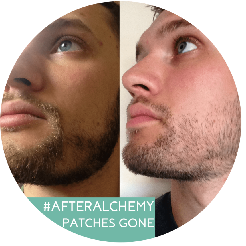 Beard Progress #afteralchemy