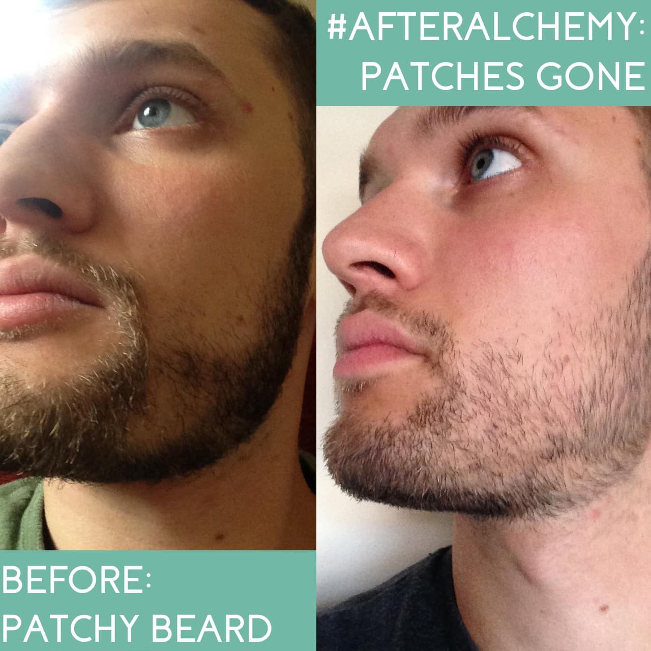 Alchemy Oils’ Peppermint Beard Oil Patchy Beard Before and After